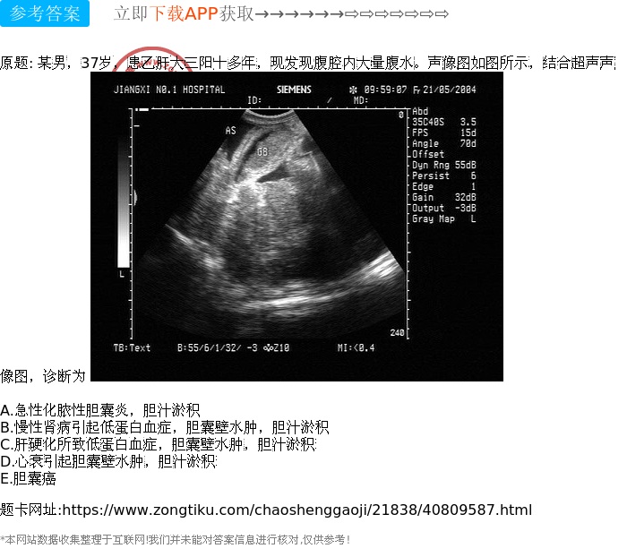 某男,37岁,患乙肝大三阳十多年,现发现腹腔内大量腹水.