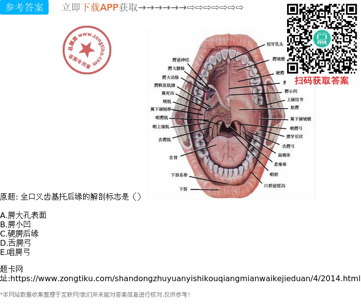 腭大孔表面 b.腭小凹 c.硬腭后缘 d.舌腭弓 e.咽腭弓