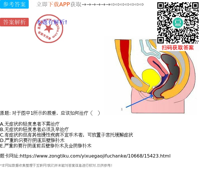 对于图中1所示的脱垂,应该如何治疗( )