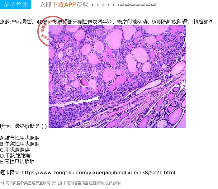 结节性甲状腺肿病理图片