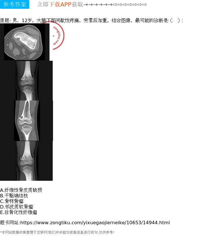 纤维性骨皮质缺损男,12岁,大腿下部间歇性疼痛,劳累后加重,结合图像