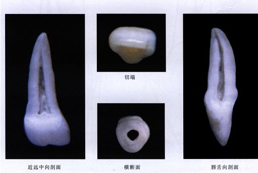 有關切牙乳頭的敘述,下列哪項是錯誤的().